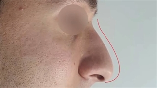 فیلم واقعی عمل بینی مردانه