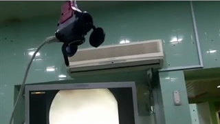 خونریزی ادراری و تومور مثانه