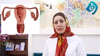 صحبت های دکتر فاطمه فیروزی در رابطه با نازایی و pco