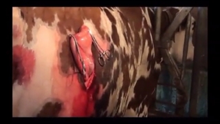 کلیپ جراحی جابجایی شیردان