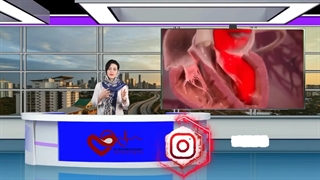 افتادگی دریچه میترال