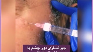 مزوژل چیست؟ با کاربردها و مزایای آن آشنا شوید