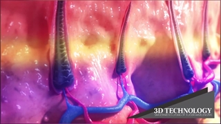 تکنولوژی 3D SHR لیزر رفع موهای زائد سوپرانو آیس تیتانیوم ۲۰۲۱