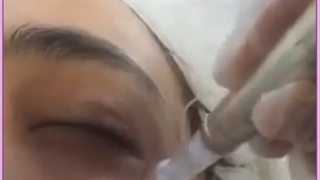 روش های شگفت انگیز درمان سیاهی و جوانسازی دور چشم