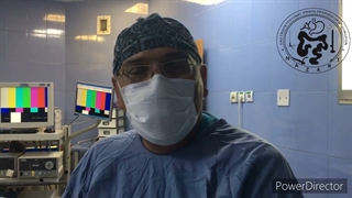 حجم برداشته شده از معده در اسلیو گاسترکتومی حدود ۸۵% است.