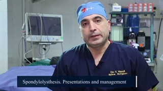 Spondylolysthesis Presentations and management