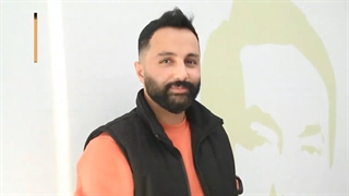 رضایتمندی از کاشت مو در کلینیک جردن