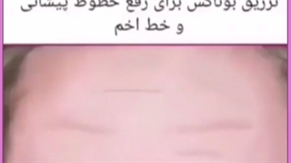 جوانسازی پوست صورت با لیزر آر اف فرکشنال (RF Fractional) تزریق بوتاکس