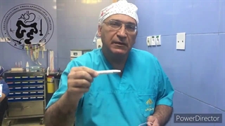 درمان همزمان جراحی لاپاروسکوپیک سنگهای کیسه صفرا و سنگ مجرای اصلی صفراوی(کلدوک)