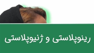 نمونه جراحی همزمان رینوپلاستی و ژنیوپلاستی