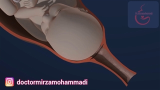 فیلم واقعی زایمان طبیعی