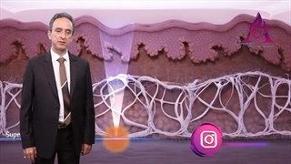 هایفوتراپی غبغب