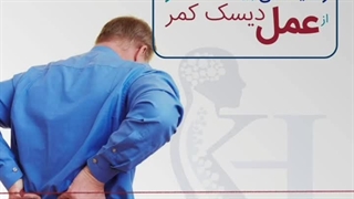 رضایت مندی بیمار از عمل دیسک کمر| دکتر اشکان خواجو