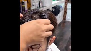Before & After Hair System Transformation | Hairline patch for men | Bono Hair