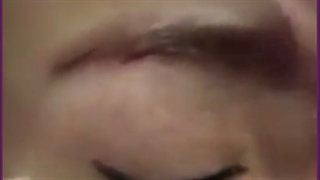 دلایل ریزش ابرو  و راه های درمان آن