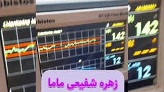 نوار قلب جنین در 37 هفتگی
