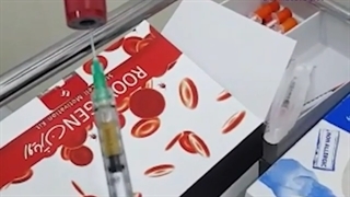 تزریق پی آر پی