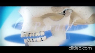 شیوع دندان قروچه با ورود کرونا و درمان آن با نایت گارد | کلینیک دندانپزشکی دکتر پورشاهی