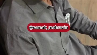 درمان جدید وزوز اهواز
