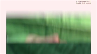 فیلم واقعی و بدون سانسور از جراحی رینوپلاستی