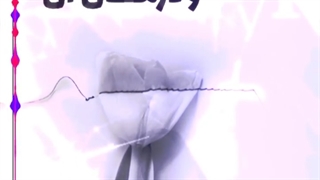 واژینیسموس چیست؟