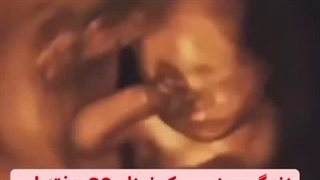 سونوگرافی جنین 30 هفته ای