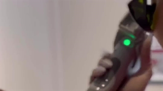 لیزر مو زائد