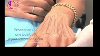 آموزش تزریق پرفکتا روی دست