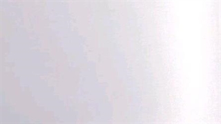 جایی که میری، لیزر ،بهداشت رو چقدر رعایت میکنه؟